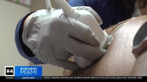 Birth rate for women over the age of 35, or mature pregnancies, is rising — CBS Miami, Boca Raton Health news