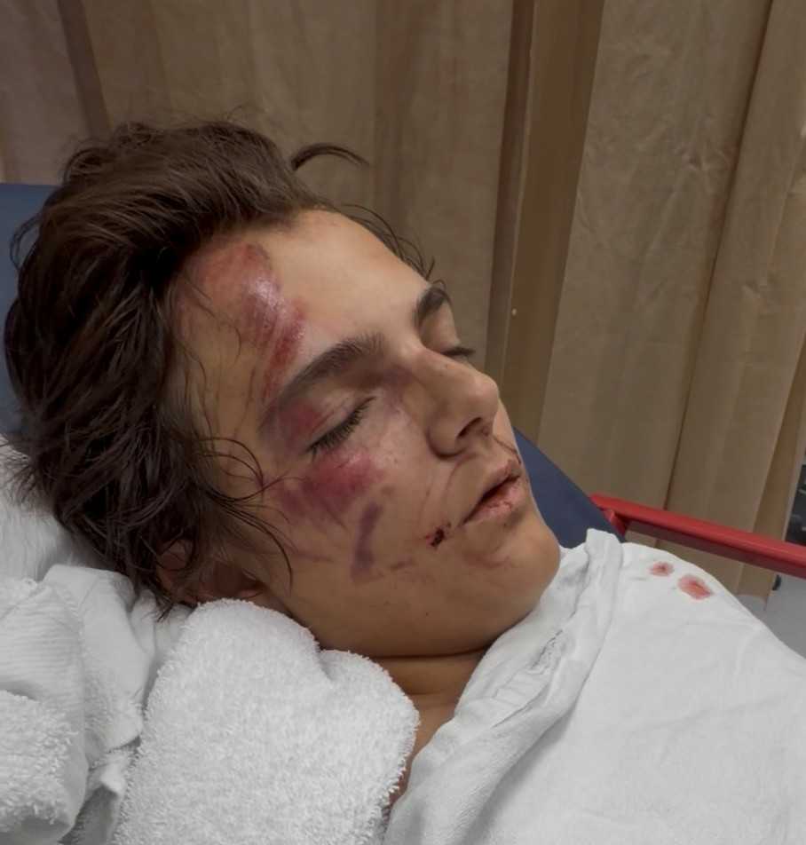 Father of boy hit by SUV in Boynton Beach urges drivers to be more careful — WPBF West Palm Beach