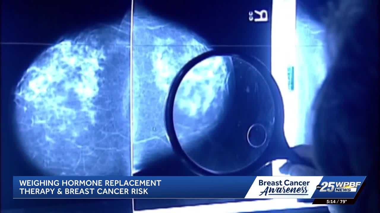 How does hormone replacement therapy affect breast cancer risk? — WPBF West Palm Beach, Boca Raton Community news